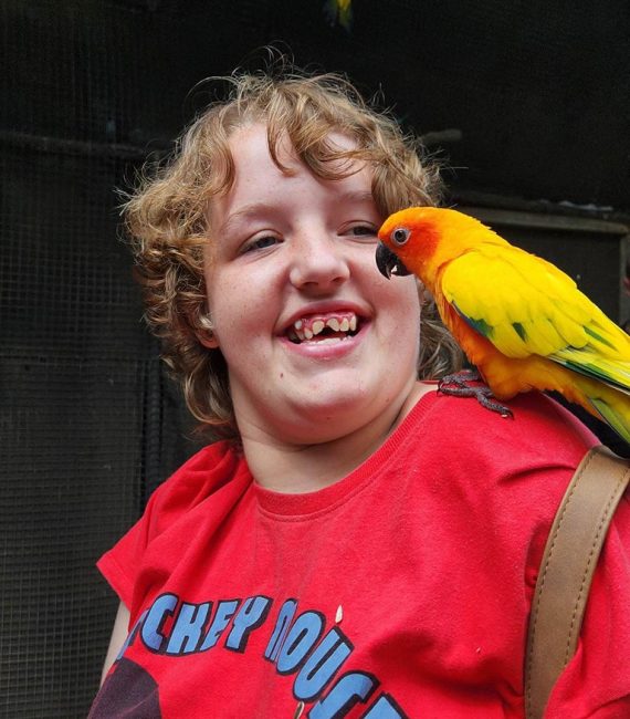 Yellow Bird On A Person's Shoulder